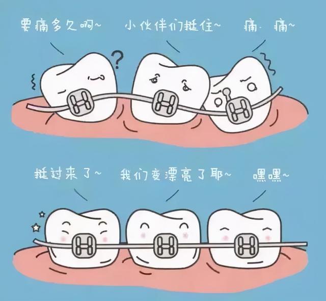 想做牙齿矫正，却一无所知？盘盘口腔正畸中的那些矫治器优缺点