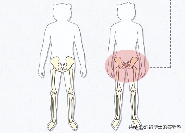为啥女生的屁股两侧,会凹进去?