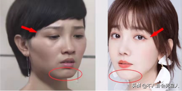 5位长相土气的女星,大刀阔斧下狠手,一步步将自己变成大美女