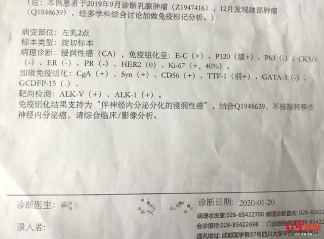 看哭了!28岁女子光头出镜记录抗癌过程,希望大家重视健康