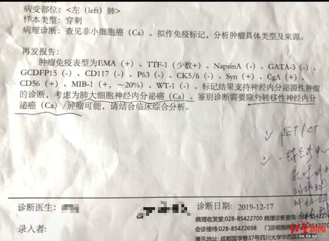 看哭了!28岁女子光头出镜记录抗癌过程,希望大家重视健康