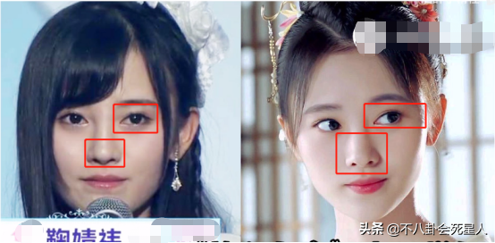 5位长相土气的女星,大刀阔斧下狠手,一步步将自己变成大美女