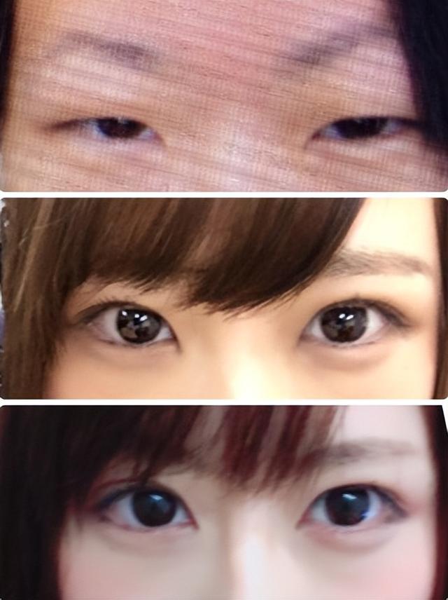 日本妹子因长得丑被欺凌,花400万整成美女,神似“有村架纯”