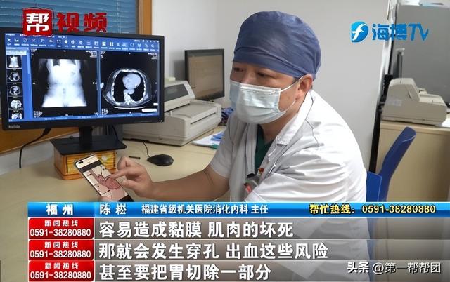女子长期恶心、反酸,竟因胃跑入胸腔?医生:这个作息习惯很不好