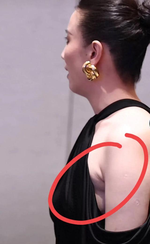 43岁宋佳近照!腋下妇乳明显,真空礼服险走光,胳膊上痕迹引热议