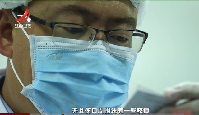 6年前单身美女死在车库中,尸检时胸前的伤痕,成为法医破案关键