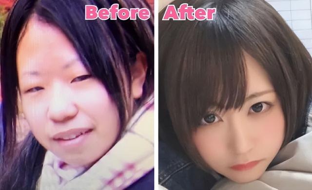 日本妹子因长得丑被欺凌,花400万整成美女,神似“有村架纯”