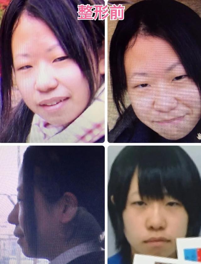 日本妹子因长得丑被欺凌,花400万整成美女,神似“有村架纯”