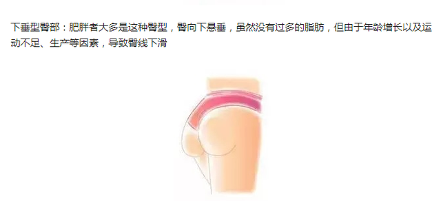 健身女士的臀部,为什么大都是明显的左右两瓣?