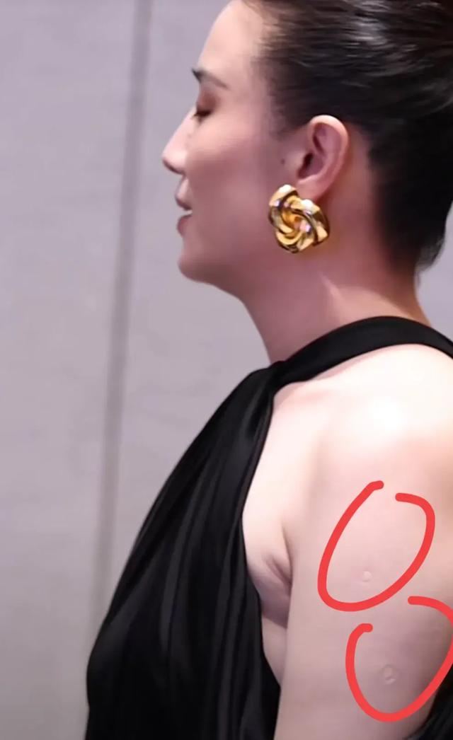 43岁宋佳近照!腋下妇乳明显,真空礼服险走光,胳膊上痕迹引热议
