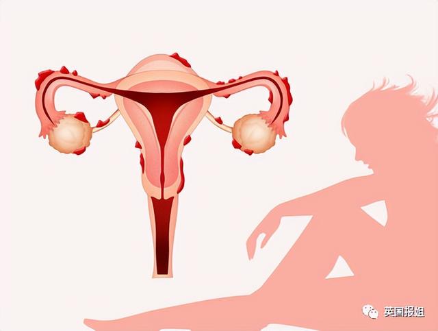 美国18岁女孩放超大响屁,竟把子宫从身体里喷出来?奇特经历爆火