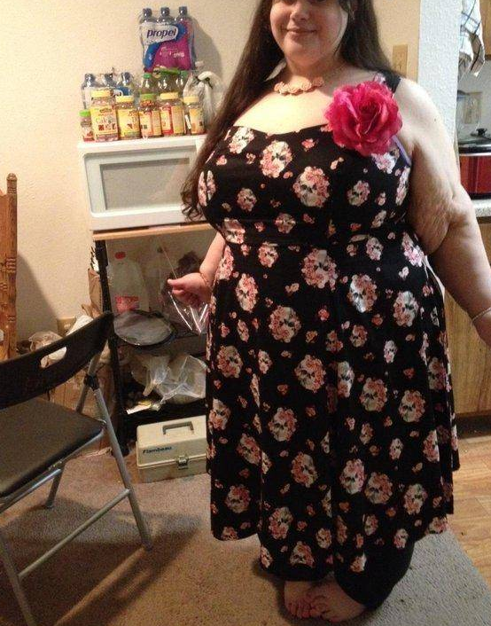 胖妞体重600斤,胖到无法行走,减肥215斤变成女神
